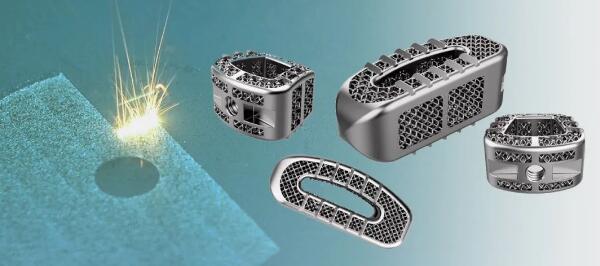 国内首款钽金属粉末床激光熔融3D打印椎间融合器产品获批上市